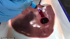 UV固化凝胶愈合伤口